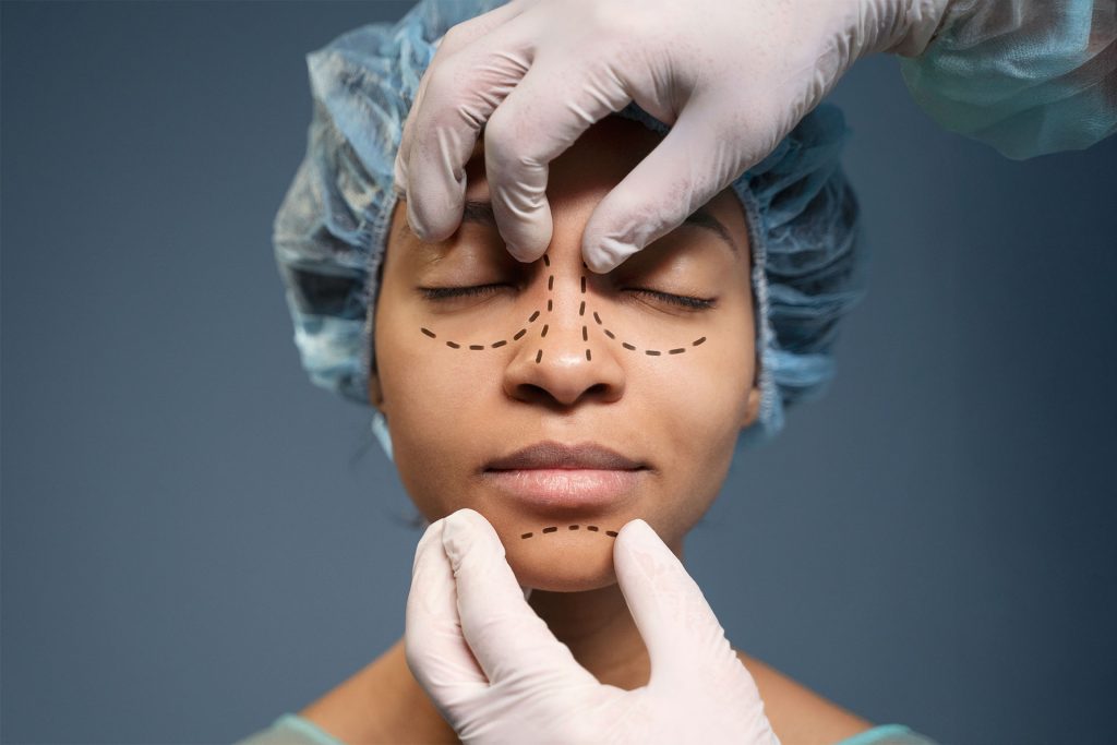 Facial Surgery